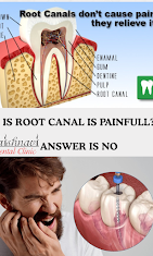 RCT